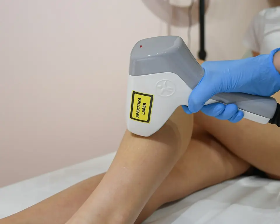 Seduta di depilazione laser diodo alle gambe nel centro Vanestetica