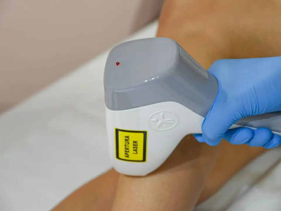 Depilazione laser diodo nel centro Vanestetica